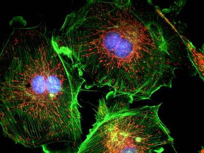 fluorescent image of three cells with membrane, nuclear, and mitochondrial staining