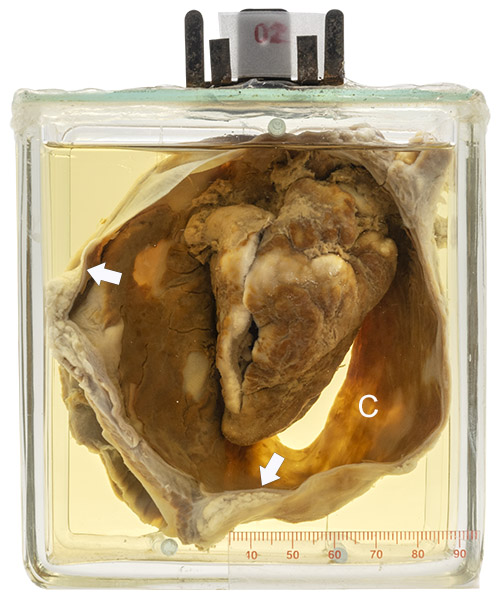 Pericardium